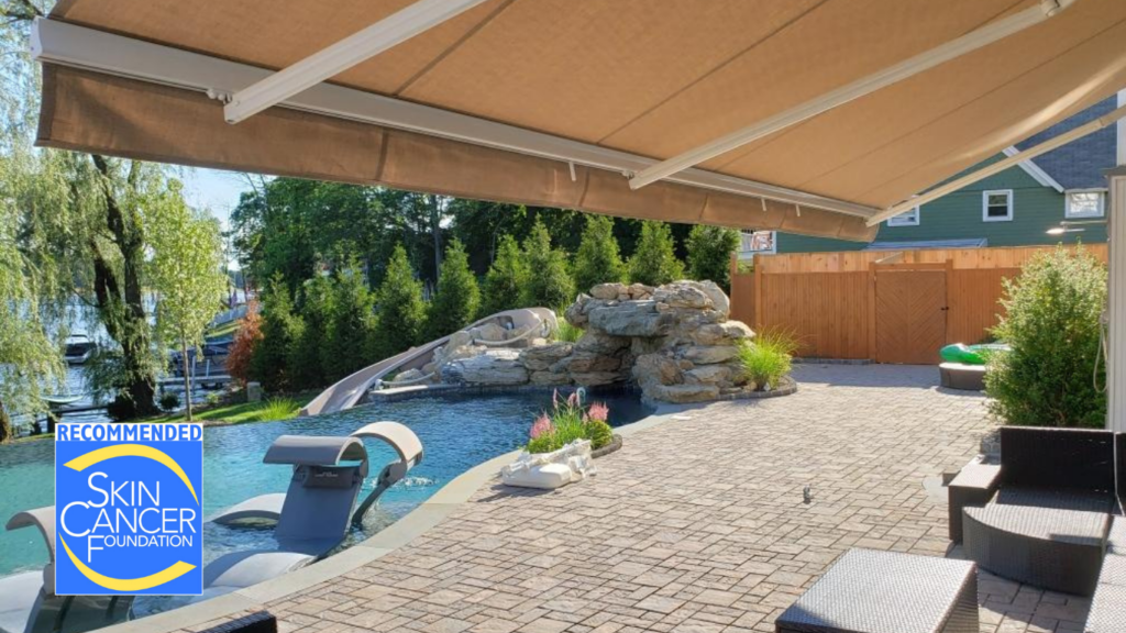 Retractable Awnings Prevent Skin Cancer 1