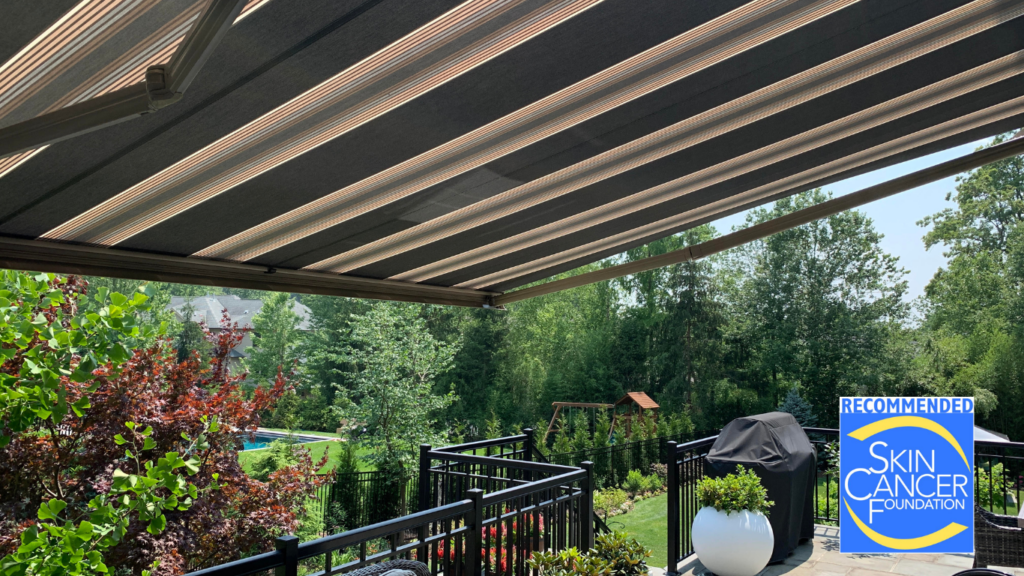 Retractable Awnings Prevent Skin Cancer